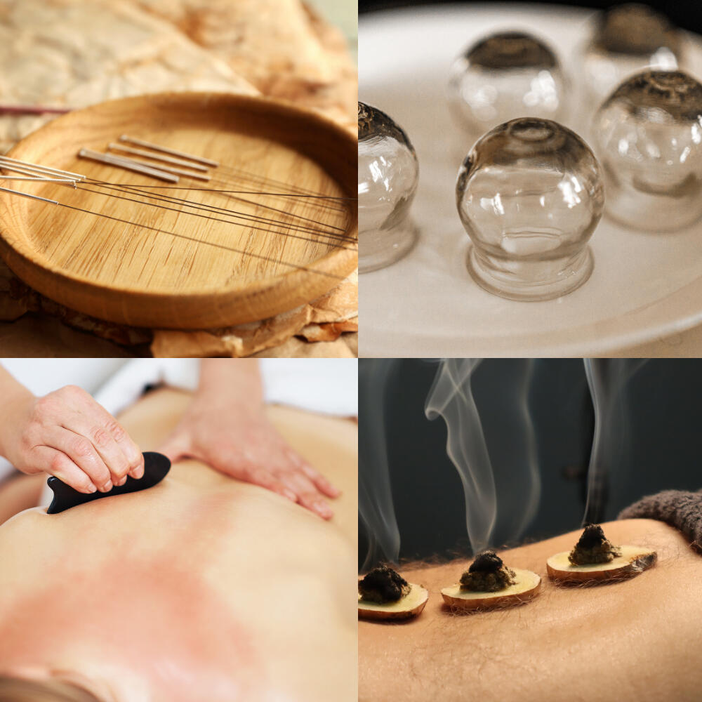 Techniques de médecine chinoise Aiguilles d’acupuncture, ventouses en verre, gua sha et moxibustion : techniques de médecine traditionnelle chinoise